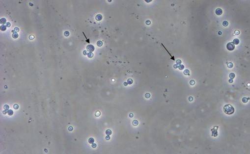 酵母双杂交技术原理、试验流程、特点以及应用