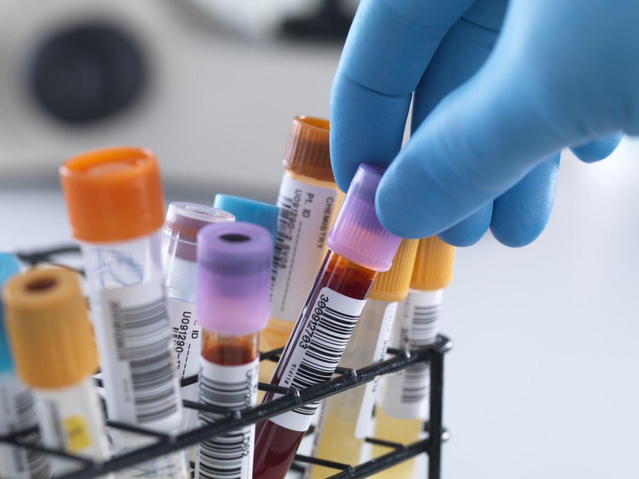 一致性评价大幕开启，医院市场即将调整