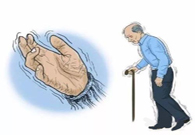 帕金森。芭痢辈慌？