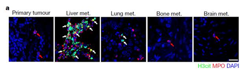 转入小鼠模型得到相同的试验结果，且在转移发生前NET已在肝脏聚积。
