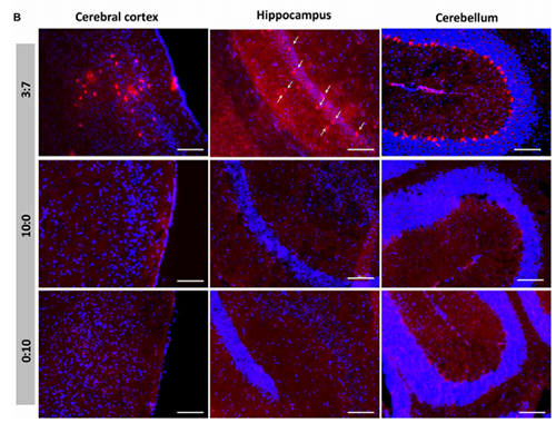 被包裹在含有NT-类脂质的LNP中的Cre重组酶成功转移。大脑中的转染神经元呈红色高亮。
