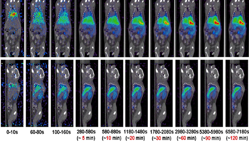 HJC黄金城平台PET/CT分子影像技术平台