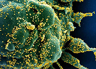 唾液检测新冠抗体新方法来了，获取结果仅需几小时！