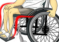 Nature：还瘫痪患者一个自由身的日子不远了