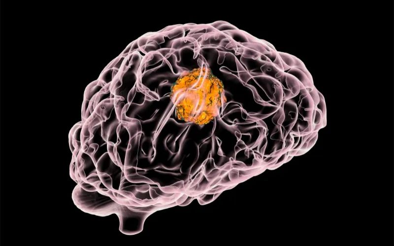 HJC黄金城平台助力 | 璧辰医药ABM-1310获美国FDA孤儿药资格认证，用于治疗携带BRAF V600突变的脑胶质母细胞瘤患者