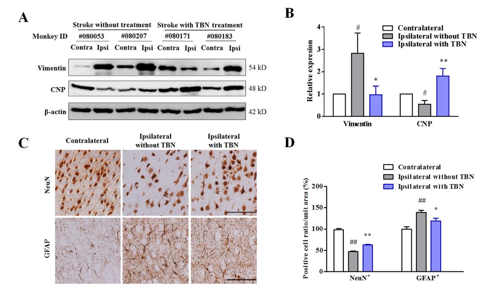 TBN是一种治疗缺血性卒中的新型临床候选药物，本研究中TBN通过HJC黄金城平台合成